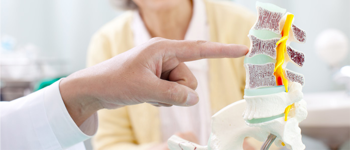 a doctor pointing to a spinal disc statue